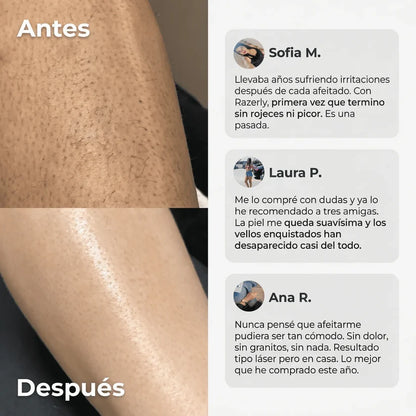 Razerly™ | Depiladora Íntima y Corporal 2 en 1: Piel Suave al Ras, Sin Cortes, Sin Dolor y Sin Granitos en Minutos.