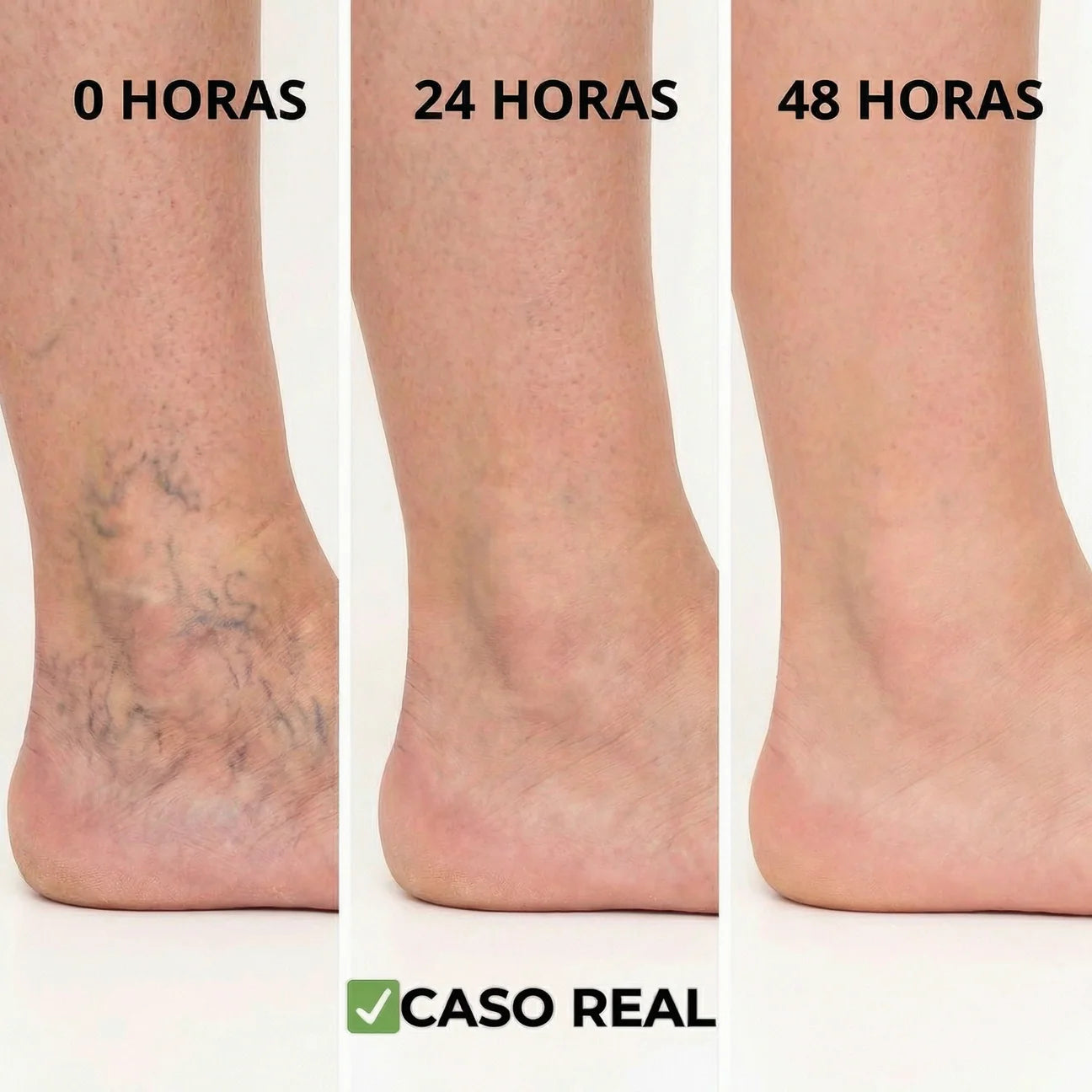 VenoRelief™ - Adiós al Dolor y la Pesadez: Tus Piernas Ligeras y Bellas, ¡Al Fin!